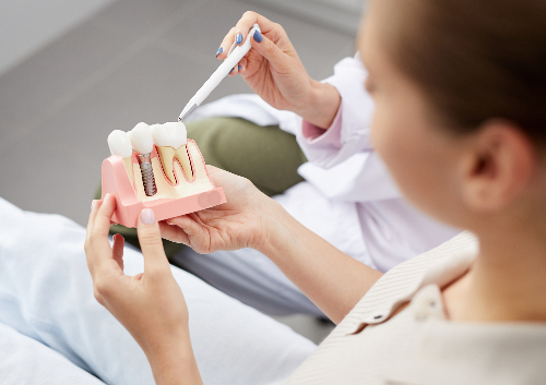 Dentist showing patient a dental implant model.