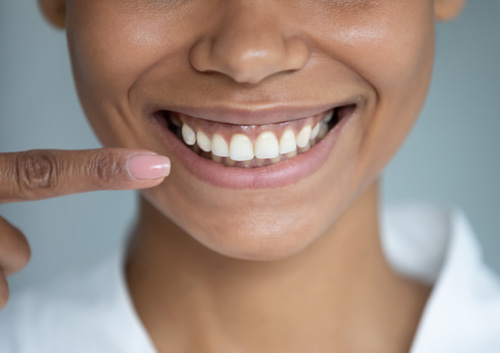 After whitening dental treatment procedure showing result