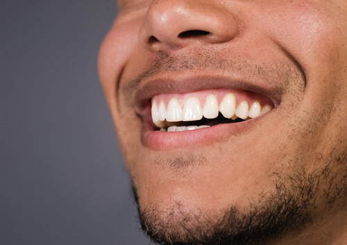 Healthy teeth