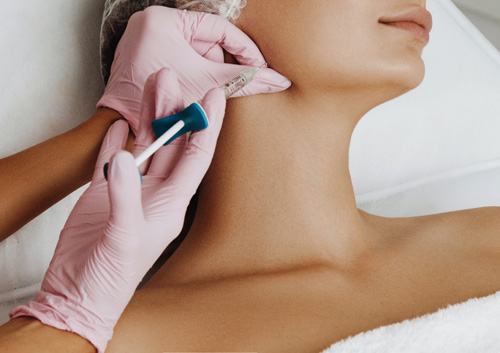 Chin filler injection