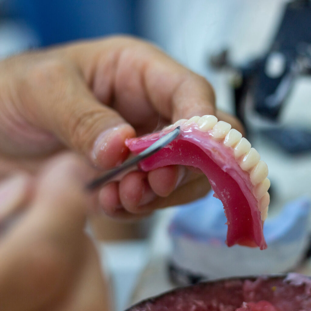 denture making