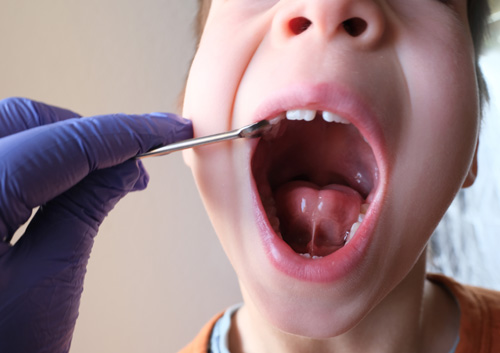 doctor examines oral cavity