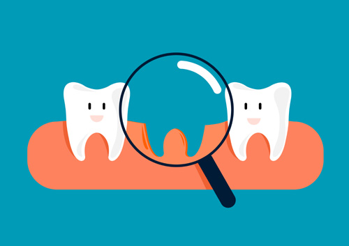 missing tooth