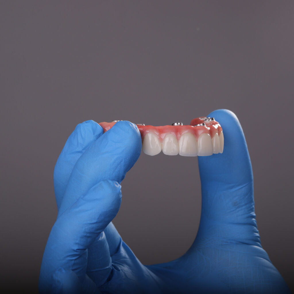 Revolutionize Your Smile with All On X Permanent Teeth: Stunning