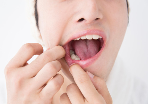 man checking teeth